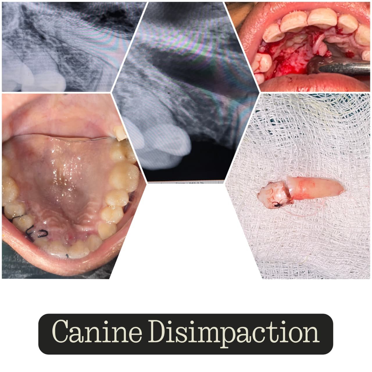 Clinical Case 01