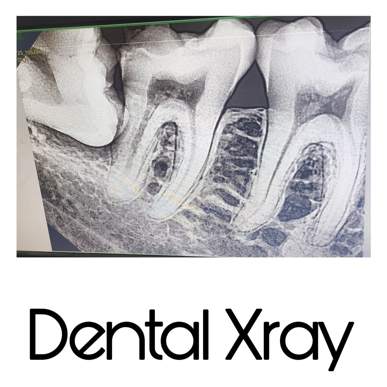 Clinical Case 03