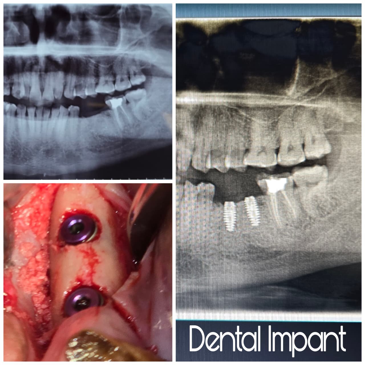 Clinical Case 04