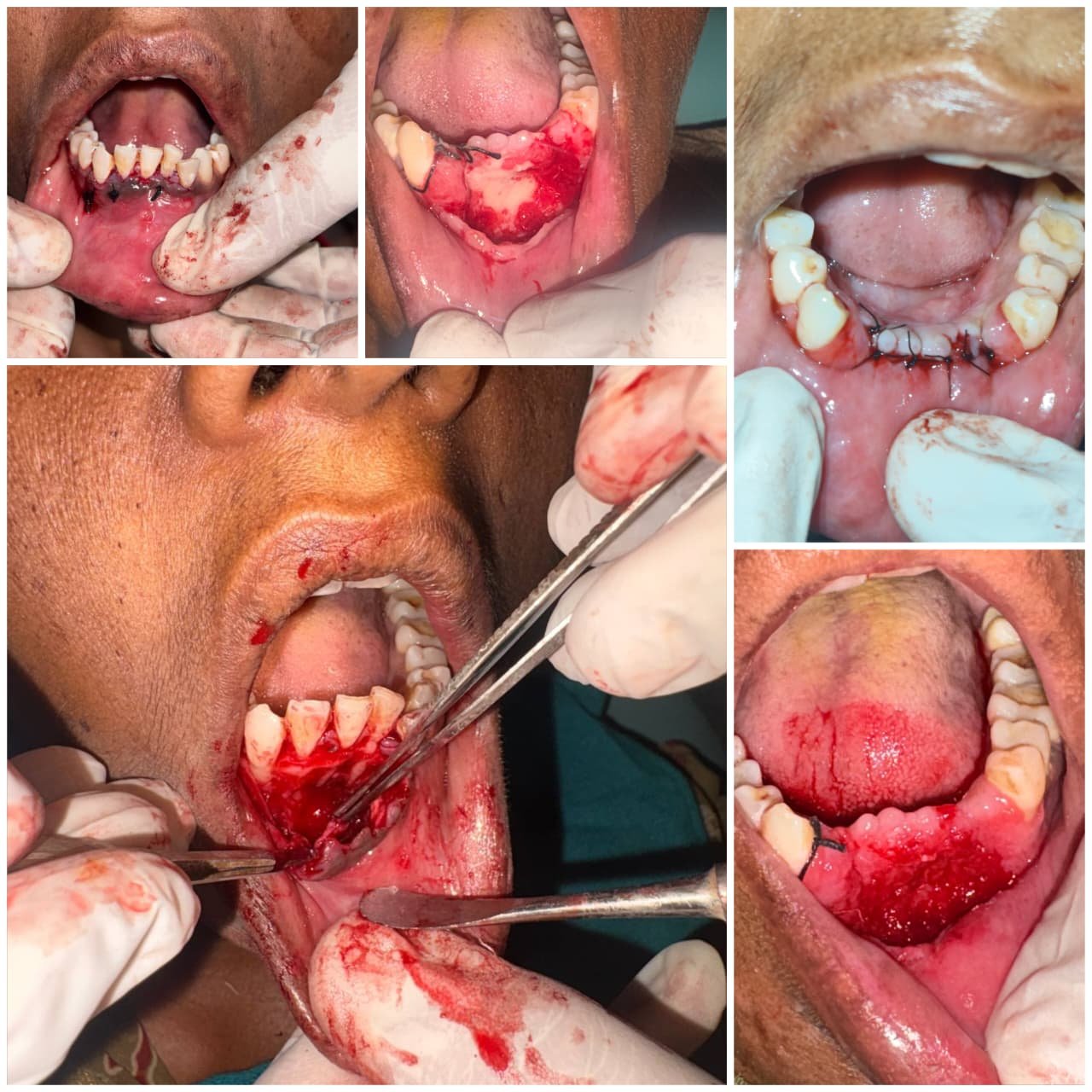 Clinical Case 05