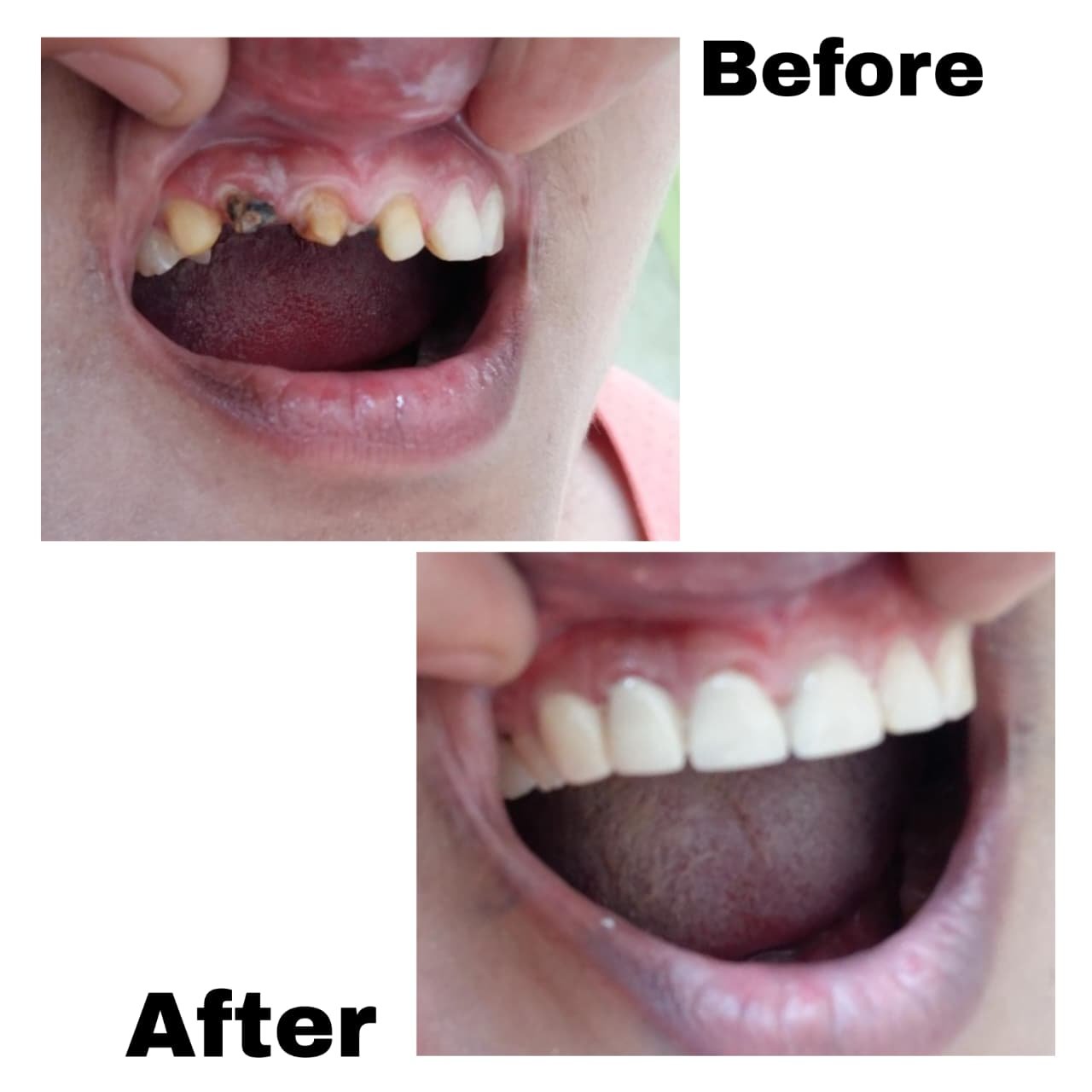 Clinical Case 08